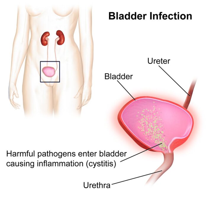 Bladder