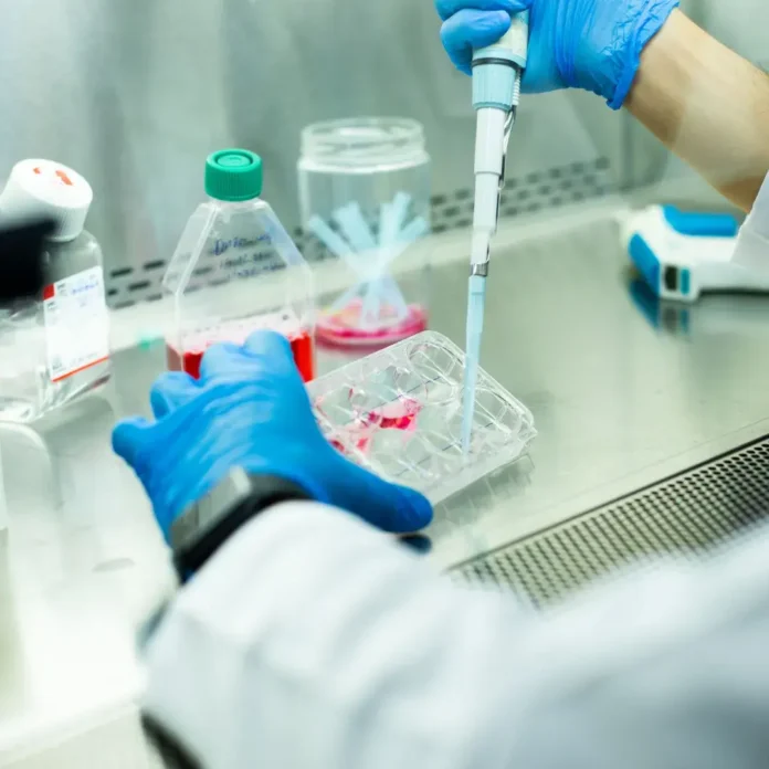 Stem Cell Therapy