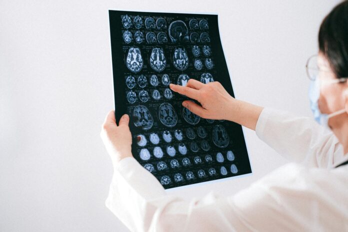Brain Injury Lawyer